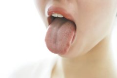 不同的舌头颜色，代表了不同的健康状况？快来对照下你自己的