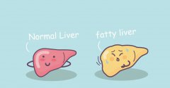 当「含脂量」5%、10%、25%时，你的肝脏会发生什么？