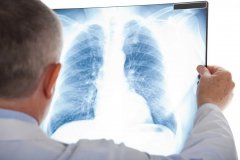 健康人「肺功能」也会异常，气短、慢性咳嗽都需警惕